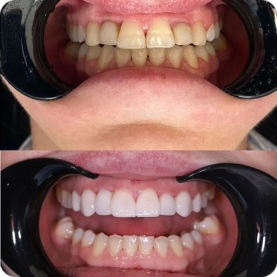 робота до/після