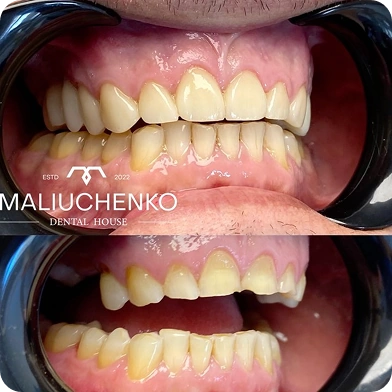 робота до/після