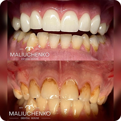 робота до/після