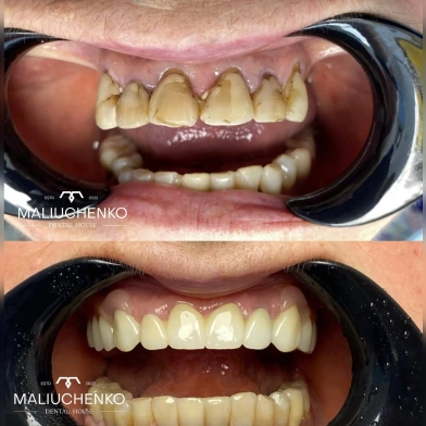 робота до/після