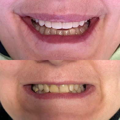 робота до/після